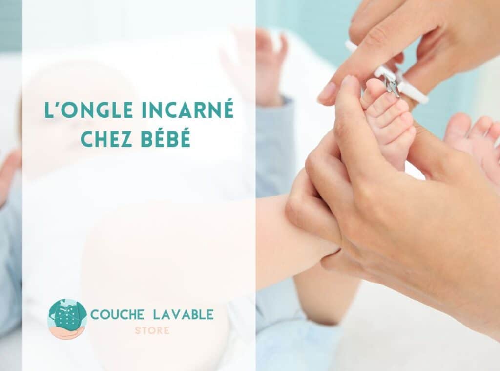 ongles incarnés chez les bébés